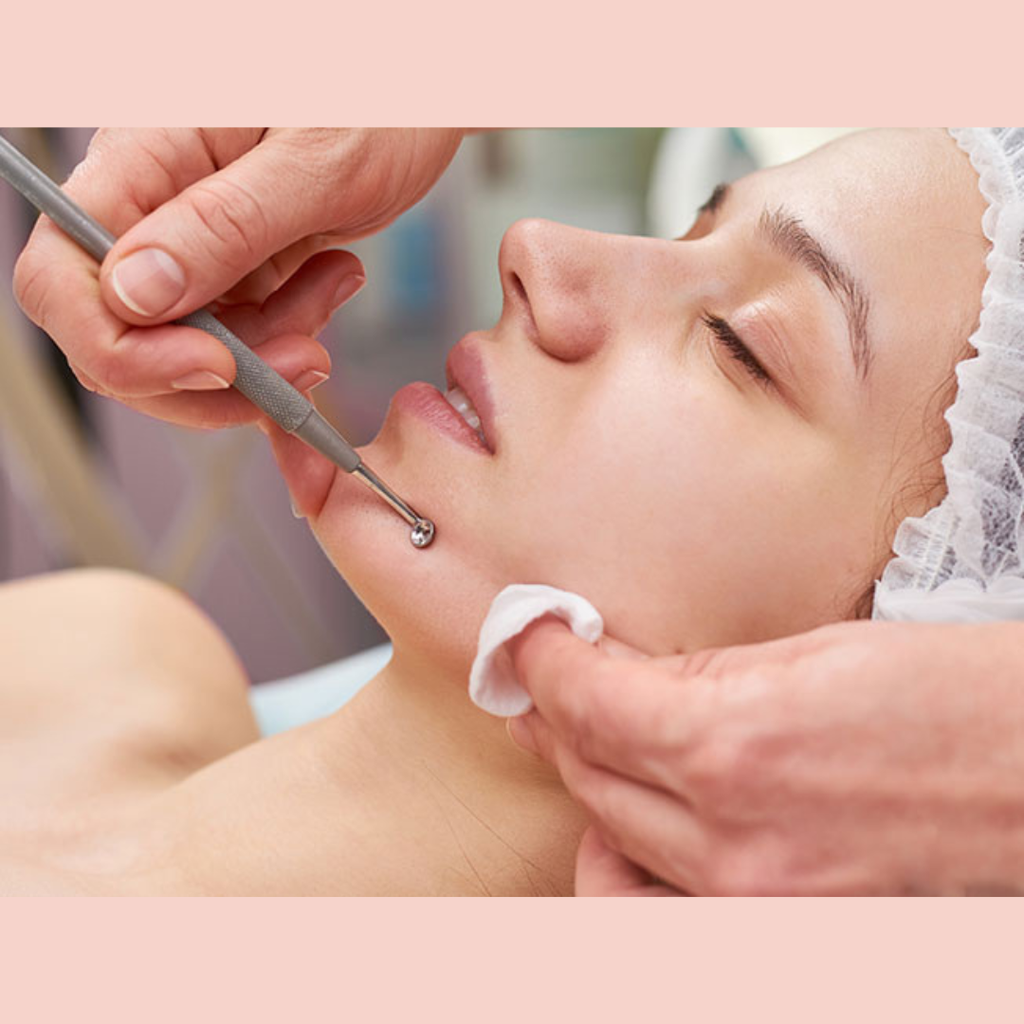 Limpieza Facial