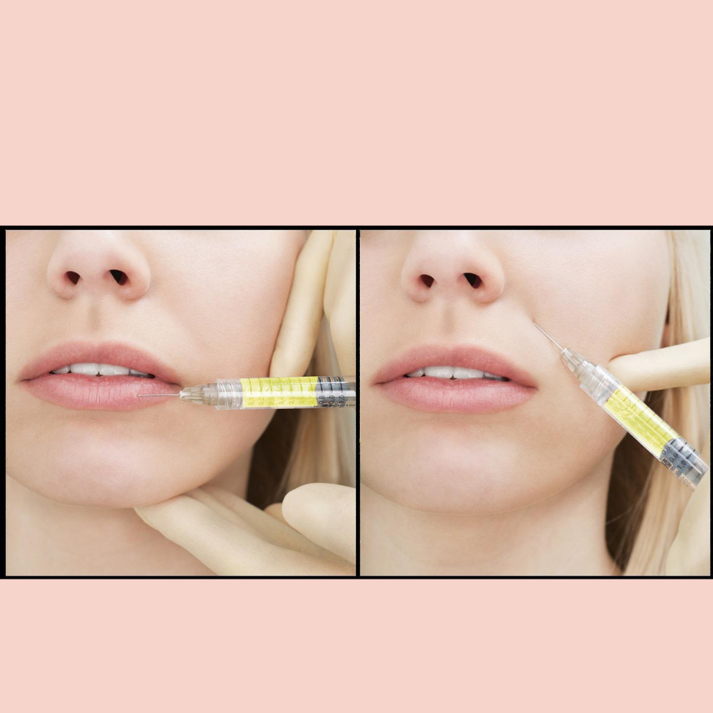 Plasma Filler